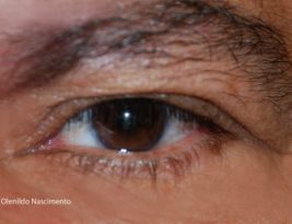 ESTOU DE OLHO! A política no picadeiro