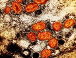 OMS declara varíola dos macacos como emergência de saúde pública internacional