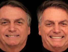 Bolsonaro faz harmonização facial de R$ 84 mil, gastando R$ 3 mil em cada dente